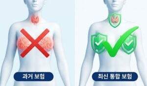 구형 보험과 신형 통합 보험의 유방암 및 갑상선암 보장 여부를 비교하는 인체 모델 인포그래픽 차트.